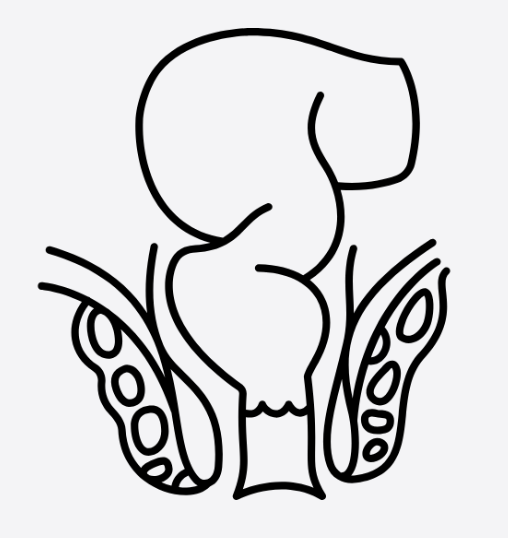 Benign anorectal