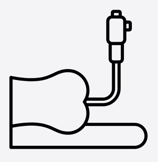 Colonoscopy