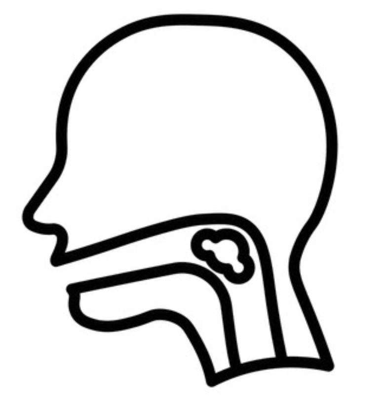 Swallowing Difficulty (Dysphagia)