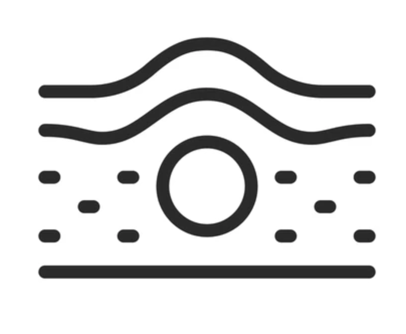Lipomas