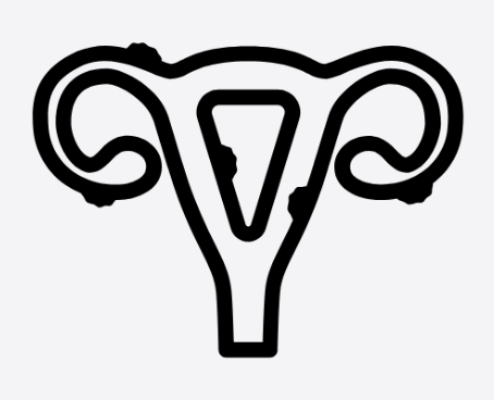 Endometriosis Treatment