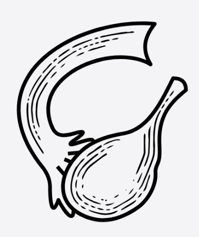 Ovarian Cystectomy